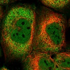 Immunofluorescent staining of human cell line A-431 shows localization to nucleoplasm & cytosol.