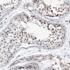 Immunohistochemical staining of human testis shows strong nuclear positivity in cells in seminiferous ducts.