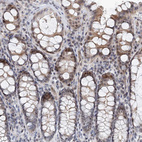 Immunohistochemical staining of human colon shows moderate nuclear positivity in glandular cells.