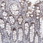 Immunohistochemical staining of human colon shows moderate nuclear positivity in glandular cells.