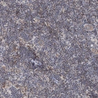 Immunohistochemical staining of human lymph node shows moderate nuclear positivity in non-germinal center cells.