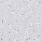 Immunohistochemical staining of human cerebral cortex shows no positivity in neurons as expected.
