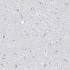 Immunohistochemical staining of human cerebral cortex shows no positivity in neurons as expected.