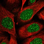 Immunofluorescent staining of human cell line U-2 OS shows localization to nucleus & nuclear bodies.