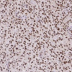 Anti-ATRX Antibody