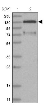 Lane 1: Marker [kDa] 230, 130, 95, 72, 56, 36, 28, 17, 11_br/_Lane 2: Human cell line RT-4