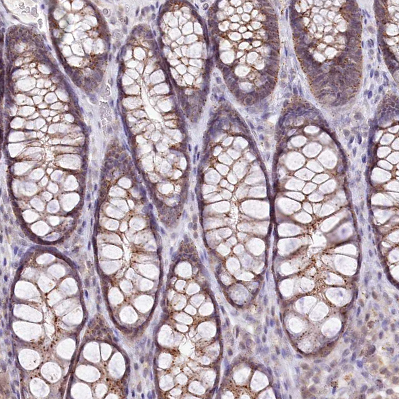 Anti-ZFYVE27 Antibody