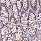 Anti-ZFYVE27 Antibody