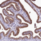 Immunohistochemical staining of human fallopian tube shows strong cytoplasmic granular positivity in glandular cells.