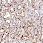 Immunohistochemical staining of human kidney shows strong cytoplasmic granular positivity in cells in tubules.