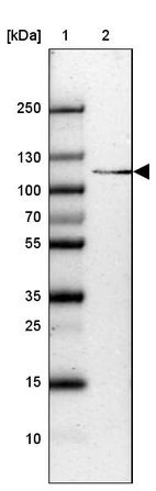 Lane 1: Marker [kDa] 250, 130, 100, 70, 55, 35, 25, 15, 10_br/_Lane 2: Human cell line HepG2