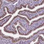 Immunohistochemical staining of human fallopian tube shows strong nuclear positivity in glandular cells.