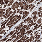 Anti-HADHB Antibody