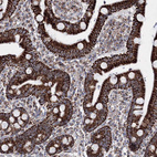 Immunohistochemical staining of human duodenum shows strong granular cytoplasmic positivity in glandular cells.
