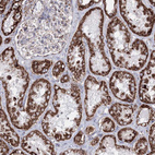 Immunohistochemical staining of human kidney shows strong granular cytoplasmic positivity in cells in tubules.