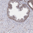 Immunohistochemical staining of human prostate shows strong granular cytoplasmic positivity in glandular cells.
