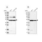 Western blot analysis using Anti-HADHB antibody HPA037539 (A) shows similar pattern to independent antibody HPA037540 (B).