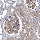 Immunohistochemical staining of human kidney shows strong membranous positivity in cells in glomeruli.
