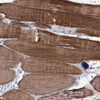 Immunohistochemical staining of human skeletal muscle shows strong cytoplasmic positivity in myocytes.