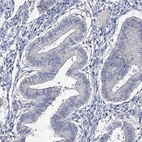 Immunohistochemical staining of human endometrium shows no cytoplasmic positivity in glandular cells as expected.