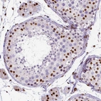 Immunohistochemical staining of human testis shows moderate to strong nuclear positivity in a subset of cells in seminiferous ducts and Leydig cells.