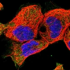 Immunofluorescent staining of human cell line A-431 shows positivity in plasma membrane.