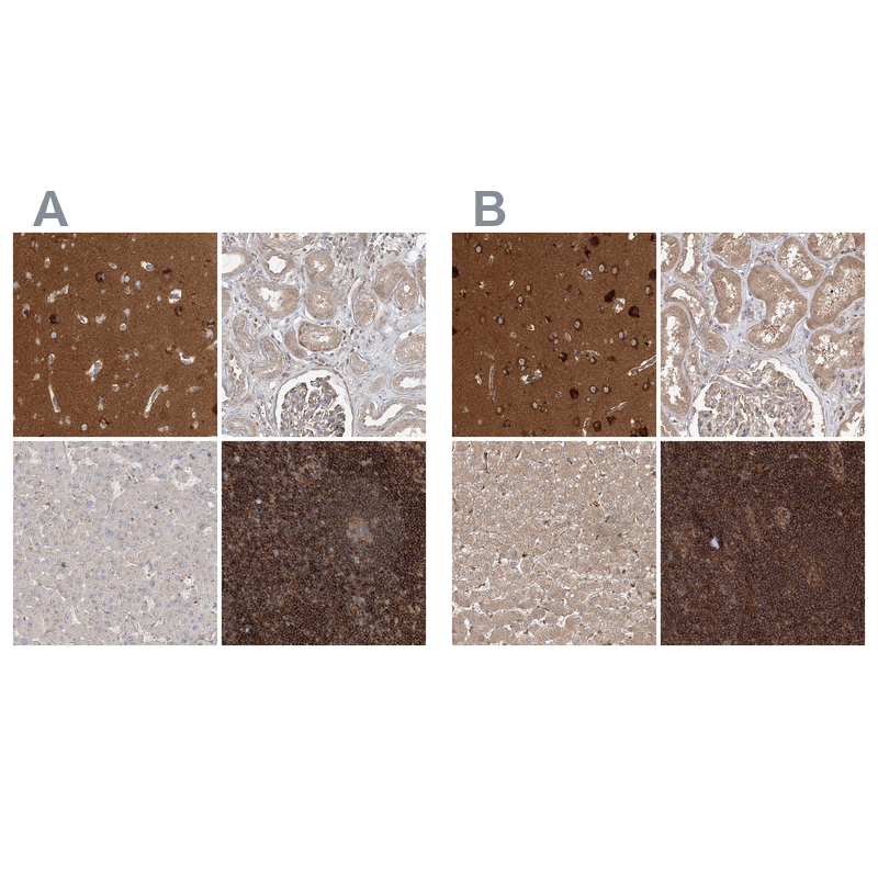 Anti-WDR37 Antibody