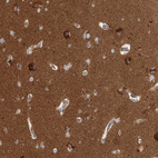 Immunohistochemical staining of human cerebral cortex shows strong positivity in neuropil.