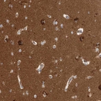 Immunohistochemical staining of human cerebral cortex shows strong positivity in neuropil.