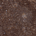 Immunohistochemical staining of human lymph node shows strong cytoplasmic positivity in non-germinal center cells.