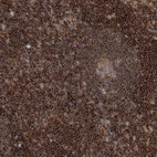 Immunohistochemical staining of human lymph node shows strong cytoplasmic positivity in non-germinal center cells.