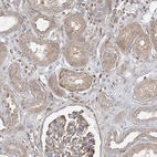 Immunohistochemical staining of human kidney shows weak cytoplasmic positivity in cells in tubules.