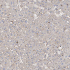 Immunohistochemical staining of human liver shows very weak positivity in hepatocytes as expected.