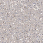 Immunohistochemical staining of human liver shows very weak positivity in hepatocytes as expected.