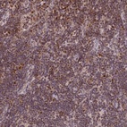 Immunohistochemical staining of human lymph node shows high expression.