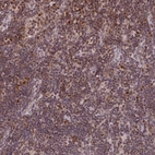 Immunohistochemical staining of human lymph node shows high expression.