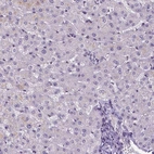 Staining of human liver shows no positivity in hepatocytes as expected.