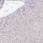 Immunohistochemical staining of human liver shows low expression as expected.