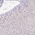 Anti-POLA2 Antibody