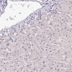 Immunohistochemical staining of human liver shows low expression as expected.