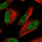 Immunofluorescent staining of human cell line U-251 MG shows localization to nucleoplasm.