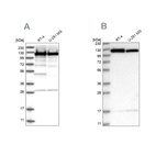Western blot analysis using Anti-KIF5B antibody HPA037590 (A) shows similar pattern to independent antibody HPA037589 (B).