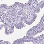 Immunohistochemical staining of human fallopian tube shows moderate positivity in ciliated cells.