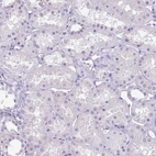 Immunohistochemical staining of human kidney shows no positivity in cells in tubules as expected.
