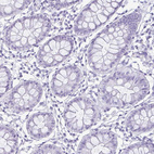 Immunohistochemical staining of human colon shows no positivity in glandular cells as expected.