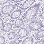 Immunohistochemical staining of human colon shows no positivity in glandular cells as expected.