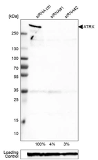 Western blot analysis in A-549 cells transfected with control siRNA, target specific siRNA probe #1 and #2, using Anti-ATRX antibody. Remaining relative intensity is presented. Loading control: Anti-GAPDH.