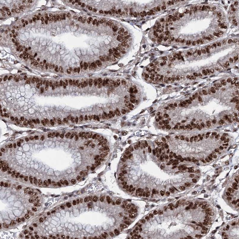 Anti-PRPF18 Antibody