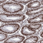 Anti-PRPF18 Antibody