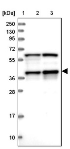 Anti-PRPF18 Antibody